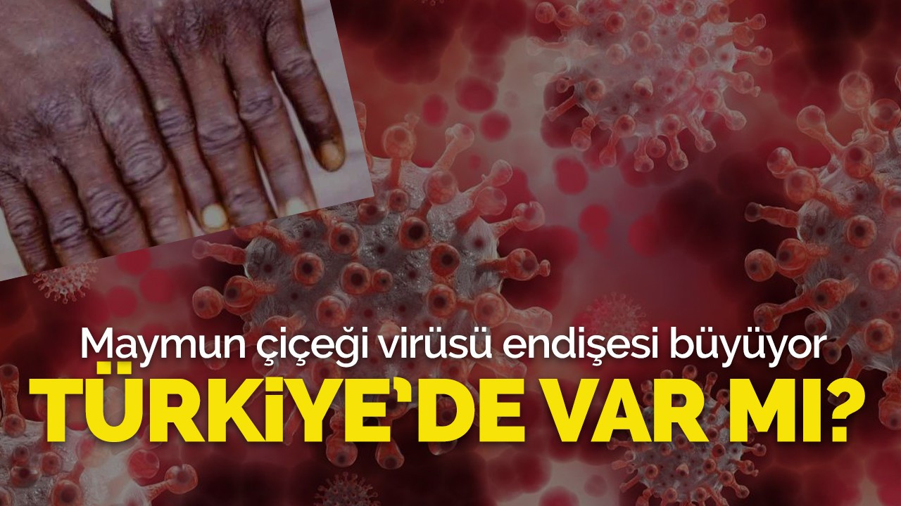 Maymun Çiçeği Virüsü iddiası! Türkiye'de var mı?