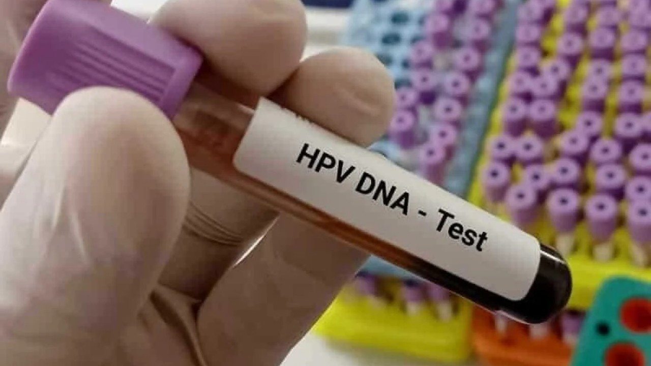 HPV testi nedir? HPV testi nasıl yapılır?