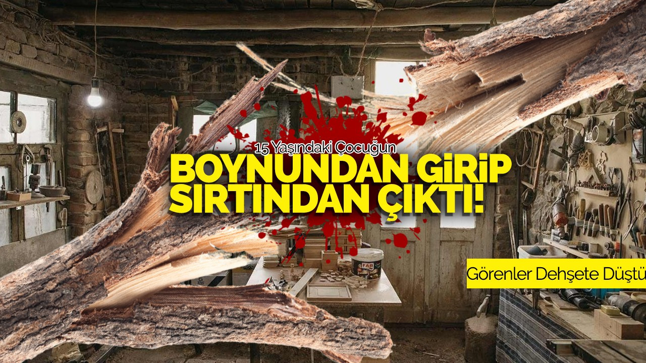 Boynundan Girip Sırtından Çıktı! Görenler Dehşete Düştü