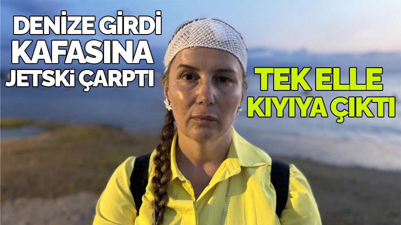 Kafasına jet ski çarptı ölümden döndü