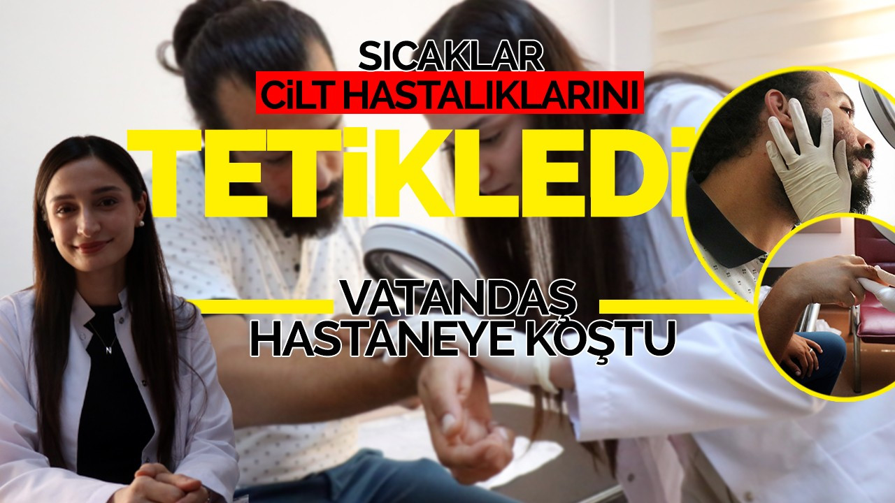 Sıcaklar Cilt Hastalıklarını Tetikledi: Vatandaş Hastaneye Koştu