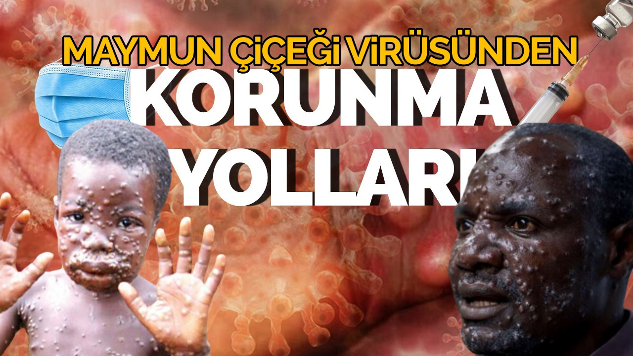 Maymun Çiçeği Virüsünden Korunma Yöntemleri