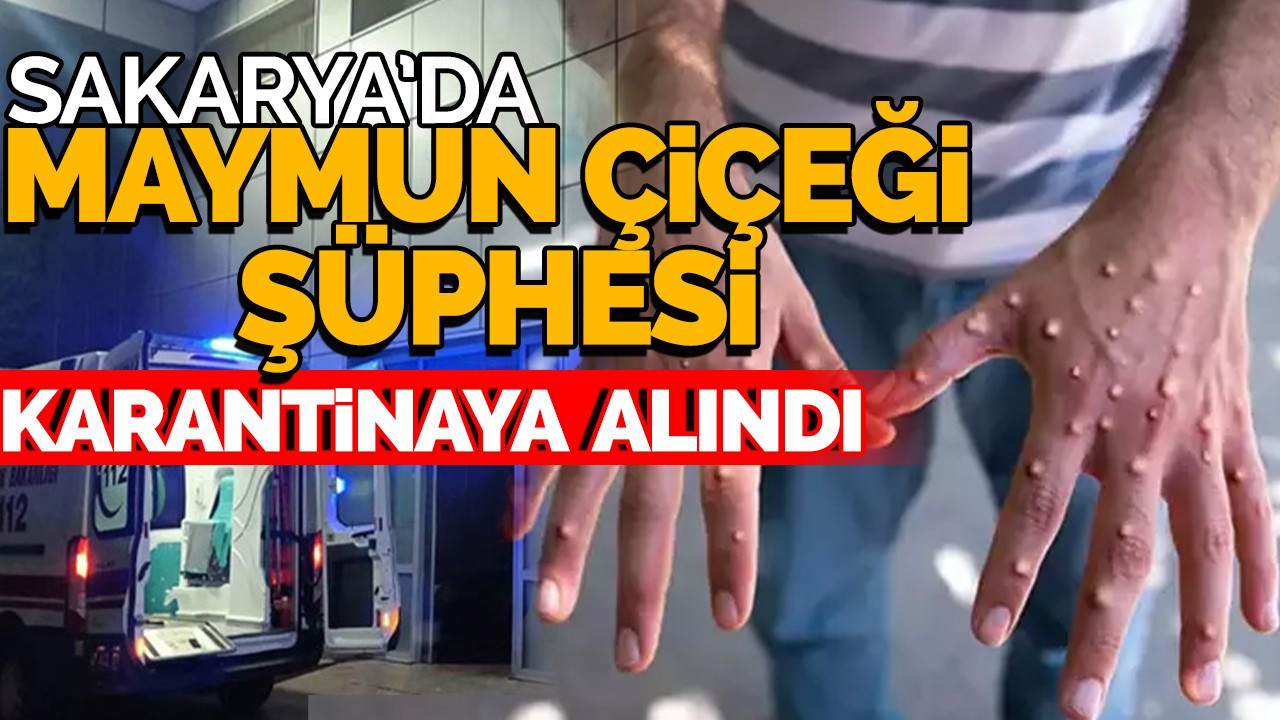 Sakarya'da Maymun Çiçeği Şüphesi: Karantinaya Alındı!