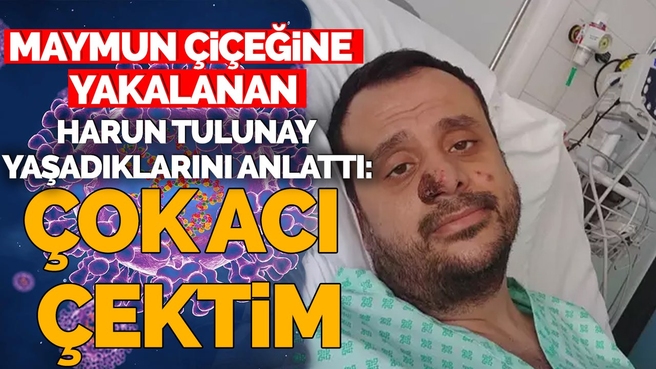 Maymun Çiçeğine Yakalanan Harun Tulunay Yaşadıklarını Anlattı