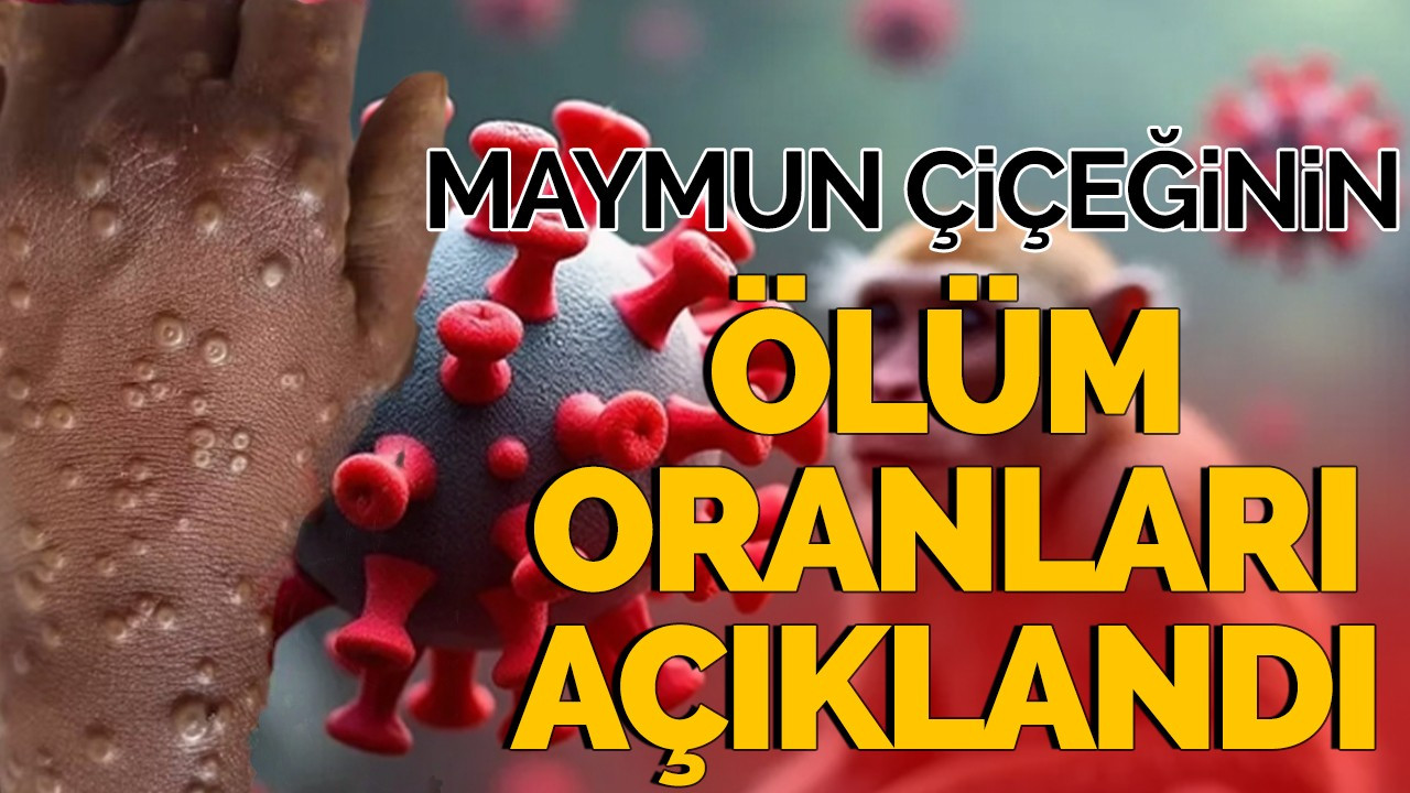 Maymun çiçeğinin ölüm oranları açıklandı!