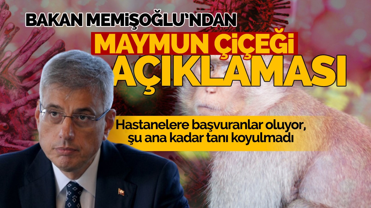 Bakan Memişoğlu'ndan maymun çiçeği açıklaması