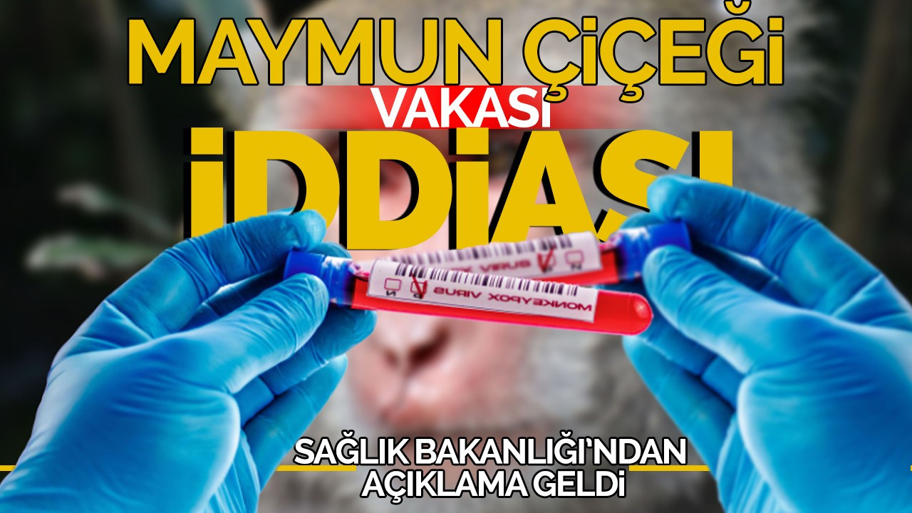 Maymun çiçeği vakası iddiası! Sağlık Bakanlığı'ndan açıklama geldi