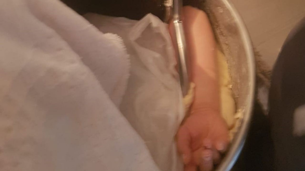 Kolunu hamur makinesine kaptırdı