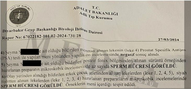 İpte Asılı Bulunan 8 Yaşındaki Çocuğun Dosyası Kapandı: İntihar mı, İstismar mı? - Sayfa 2