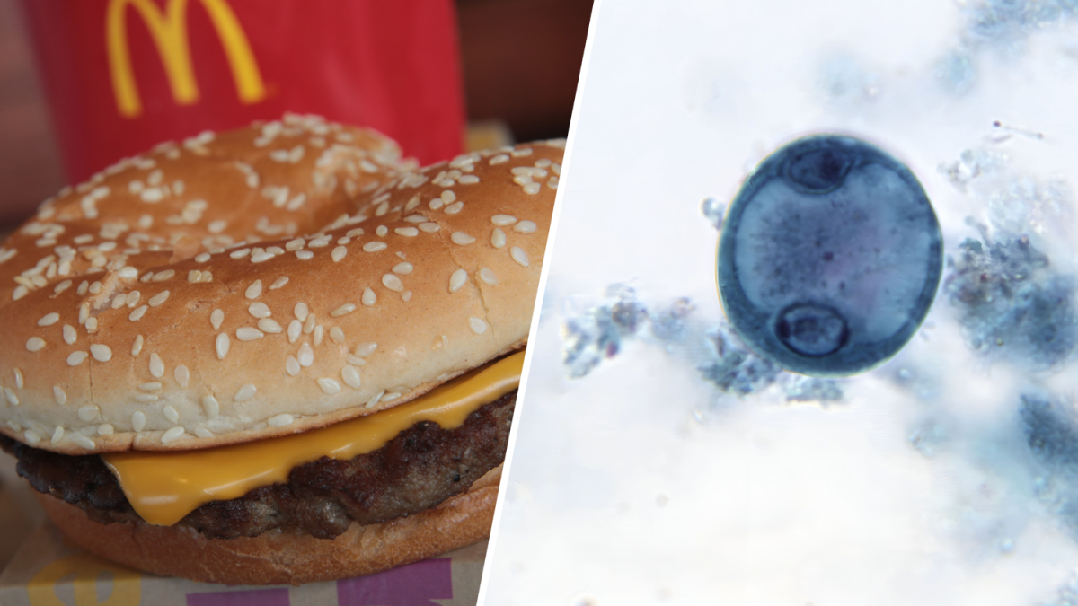 McDonald’s’da E.Coli Skandalı: Onlarca Kişi Hastanede, 1 Kişi Hayatını Kaybetti! Eğer Bu Belirtiler Varsa... - Sayfa 1