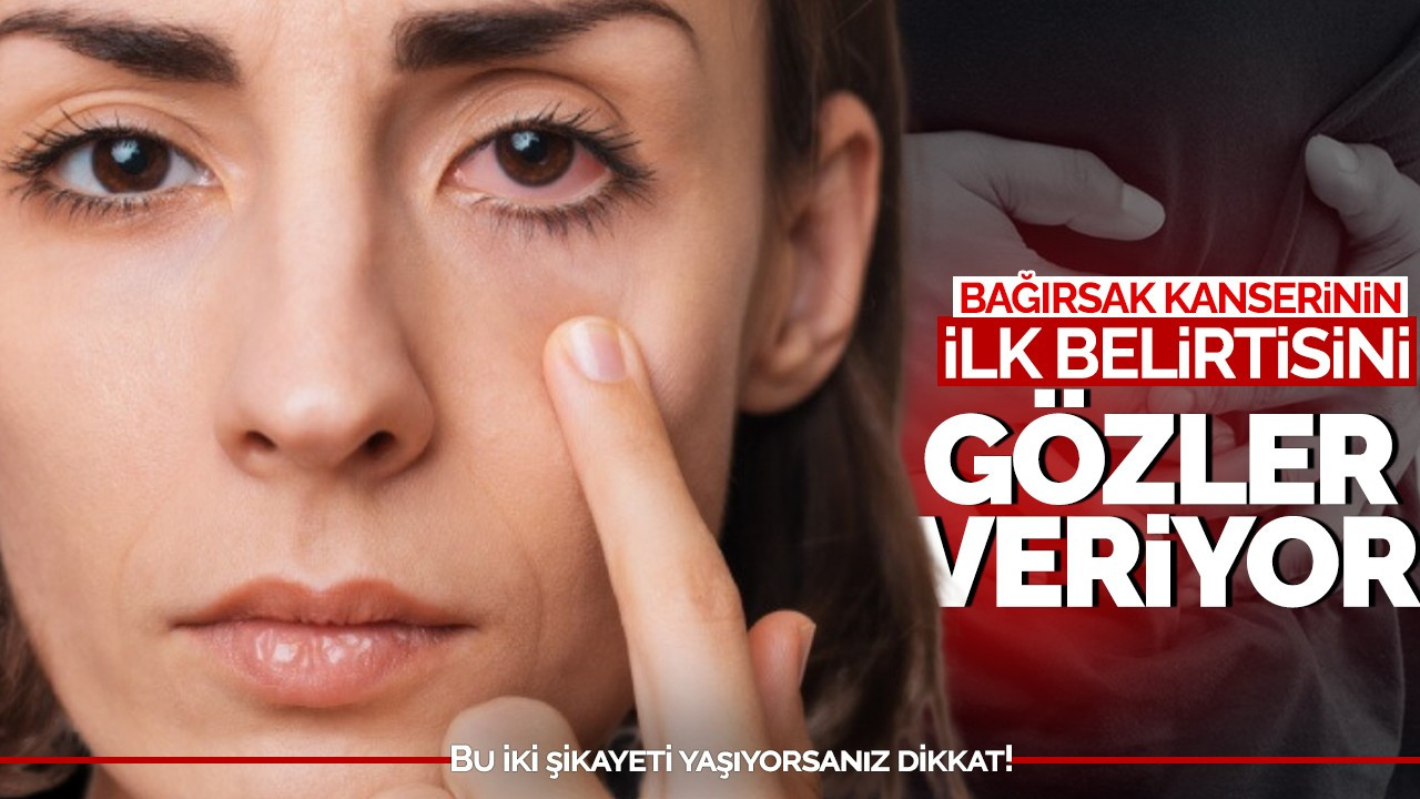 Bağırsak kanserinin ilk belirtisini gözler veriyor: Bu iki şikayeti yaşıyorsanız dikkat!