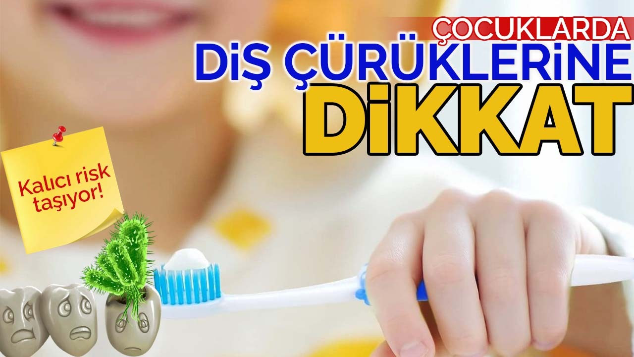 Çocuklarda Diş Çürüklerine Dikkat: Kalıcı Risk Taşıyor!