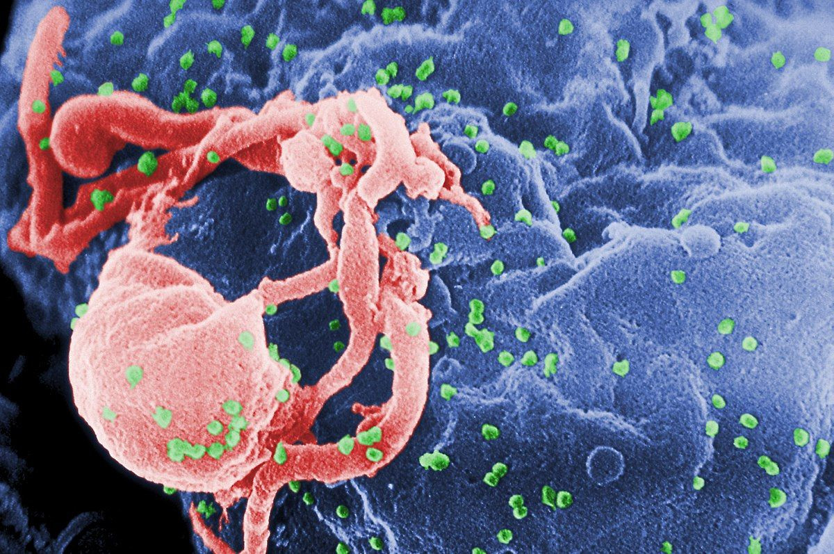 HIV Çocukları Hedef Alıyor: Türkiye'de Vakalar Artıyor, Dünya Her Dakika Bir Can Kaybediyor - Sayfa 8