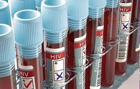 HIV Çocukları Hedef Alıyor: Türkiye'de Vakalar Artıyor, Dünya Her Dakika Bir Can Kaybediyor - Sayfa 4