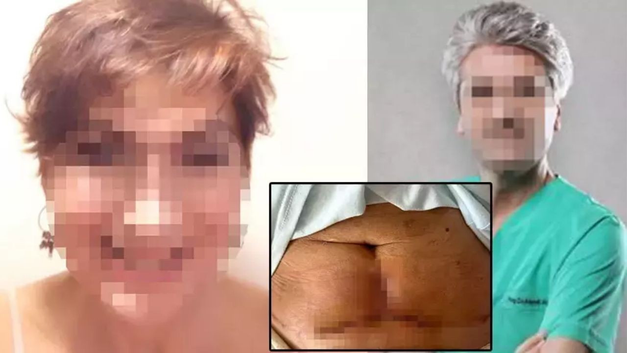Kol Ve Karın Germe Ameliyatı Oldu: Hayatı Kabusa Döndü!
