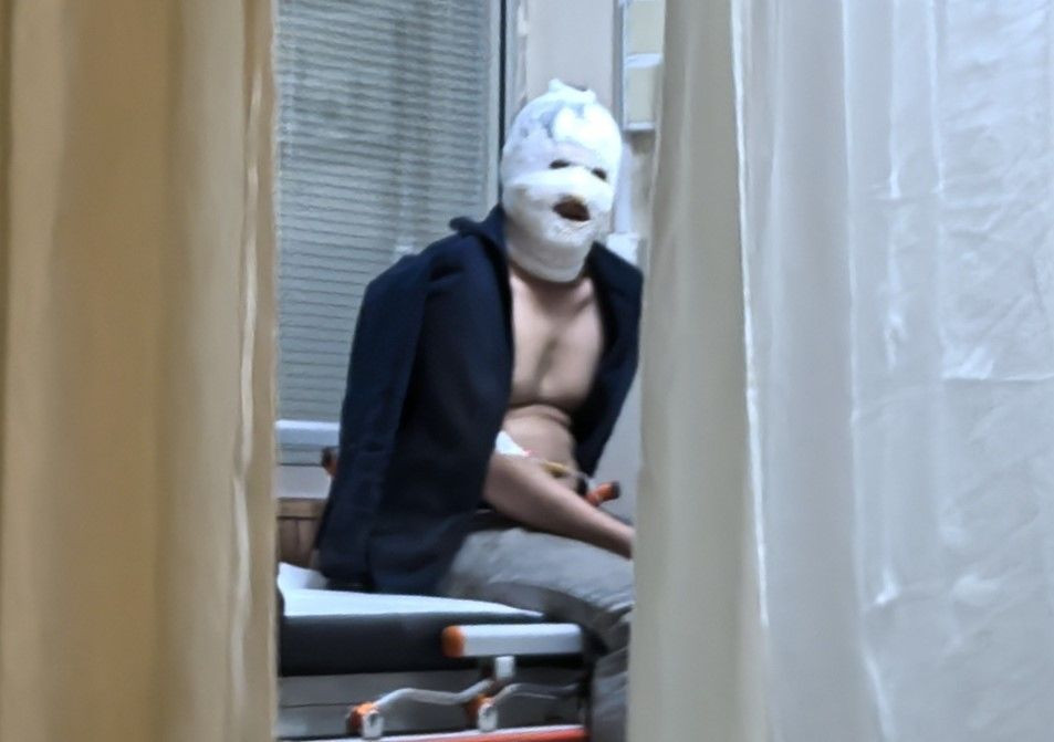 Benzinle Sobayı Tutuşturan Genç Feci Şekilde Yaralandı - Sayfa 1