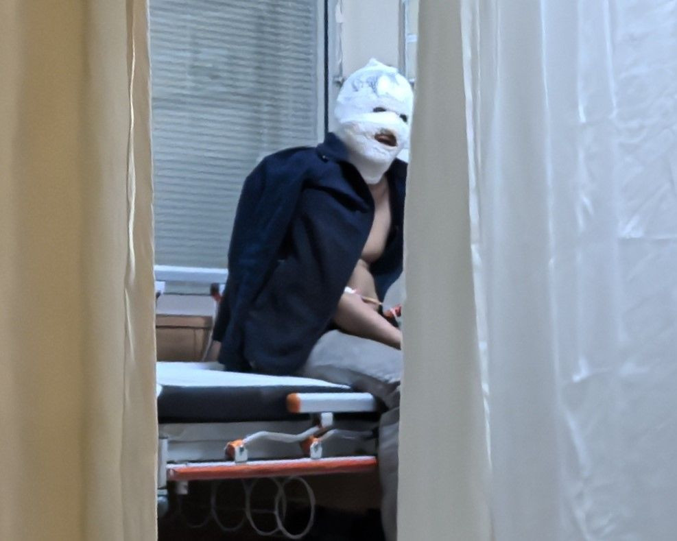 Benzinle Sobayı Tutuşturan Genç Feci Şekilde Yaralandı - Sayfa 2