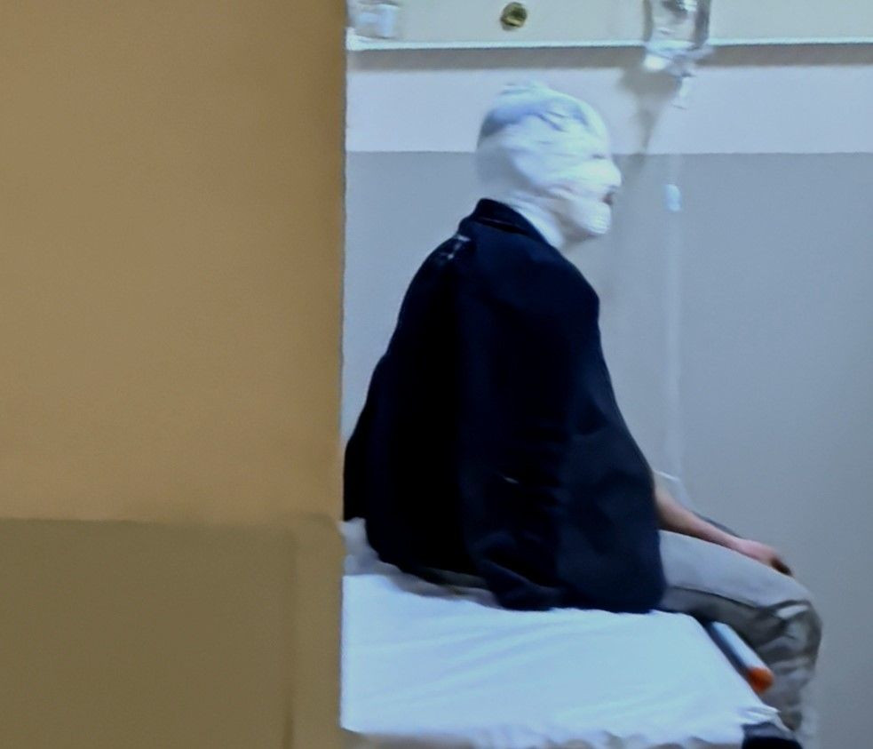 Benzinle Sobayı Tutuşturan Genç Feci Şekilde Yaralandı - Sayfa 3