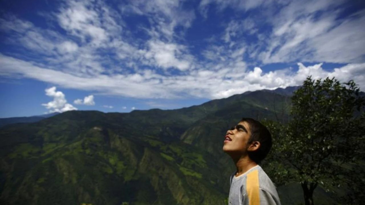 Saç Spreylerine Dikkat: İspanya'da 11 Bebekte Görüldü! - Sayfa 4