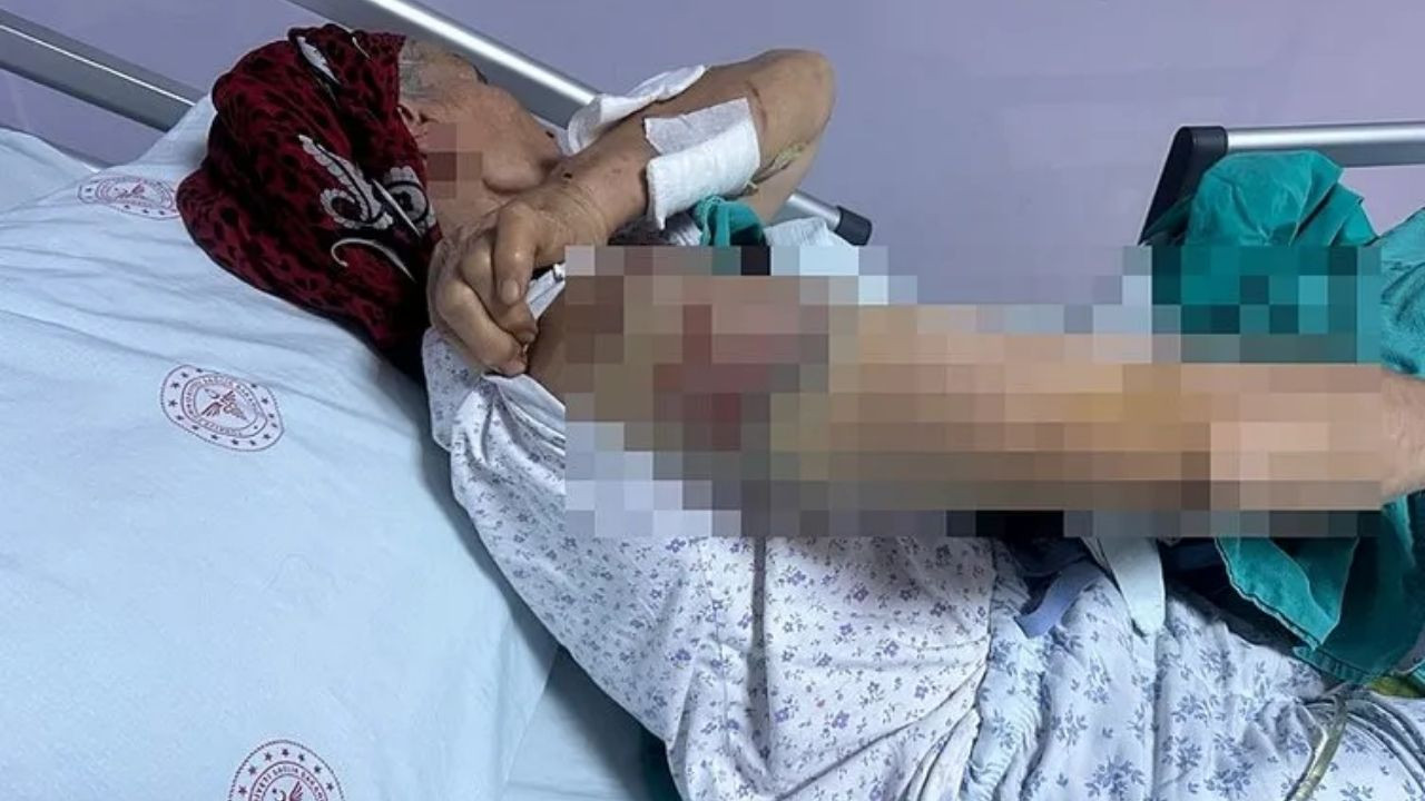 Tunceli'de 7 Sokak Köpeği 65 Yaşındaki Kadına Saldırdı: 50 Dikiş Atıldı! - Sayfa 4