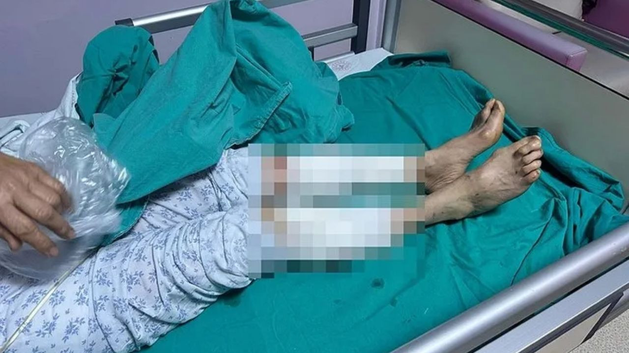 Tunceli'de 7 Sokak Köpeği 65 Yaşındaki Kadına Saldırdı: 50 Dikiş Atıldı! - Sayfa 3