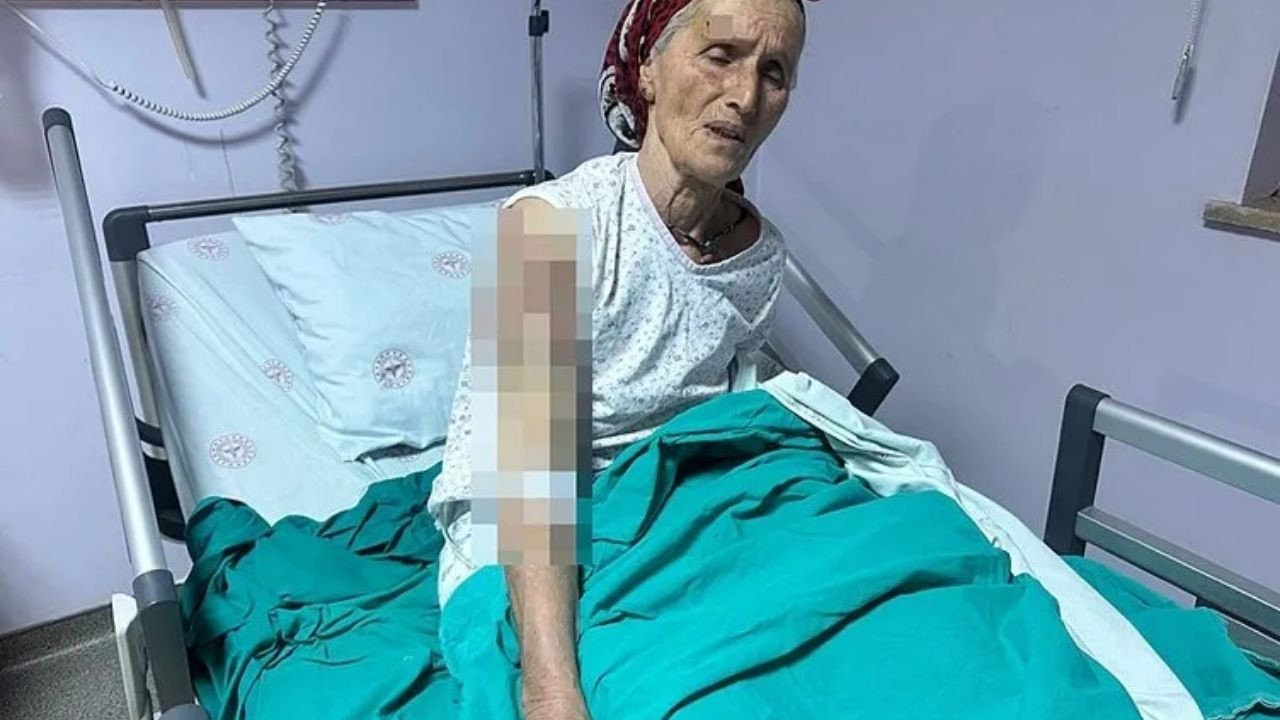 Tunceli'de 7 Sokak Köpeği 65 Yaşındaki Kadına Saldırdı: 50 Dikiş Atıldı!