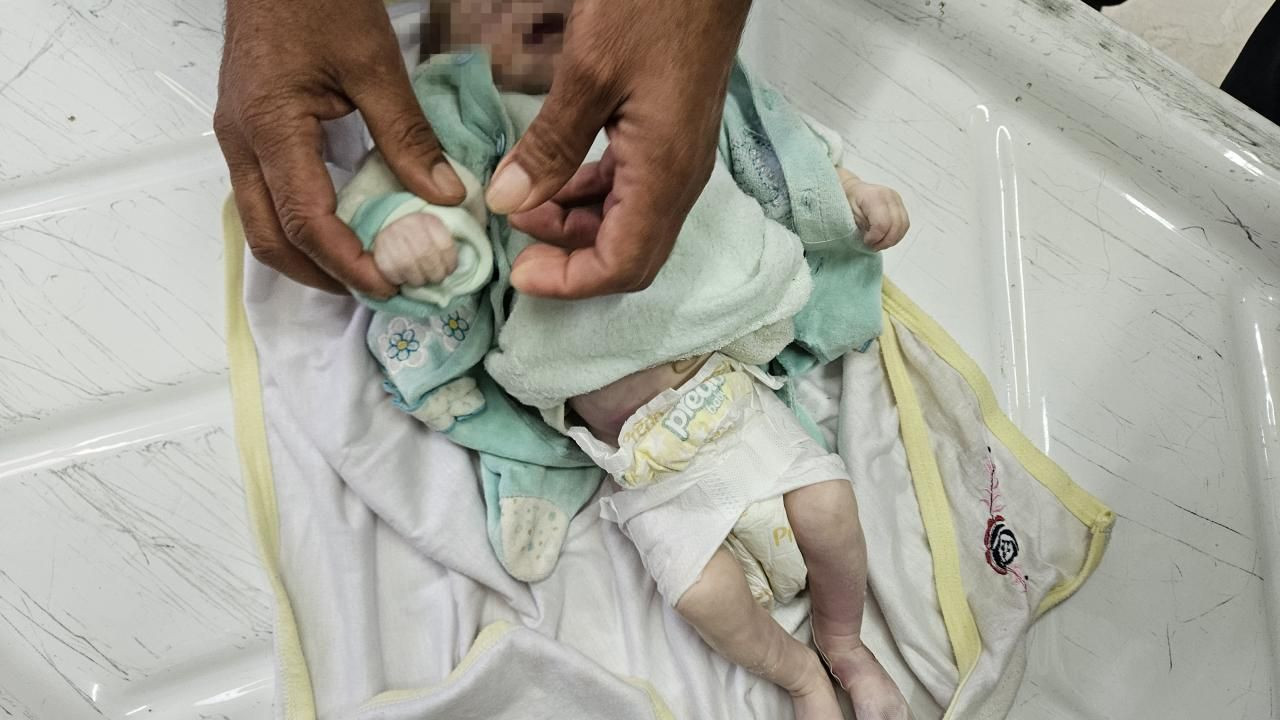 Gazze’de Çadırda Kalan Bebek Soğuk Hava Nedeniyle Hayatını Kaybetti - Sayfa 2