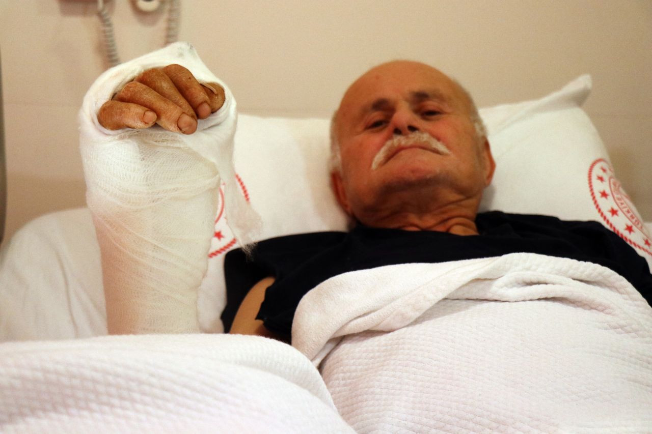 Kopan Eli Başarıyla Dikildi: "Bu Elimle Doktoruma Mangal Yapacağım" - Sayfa 1