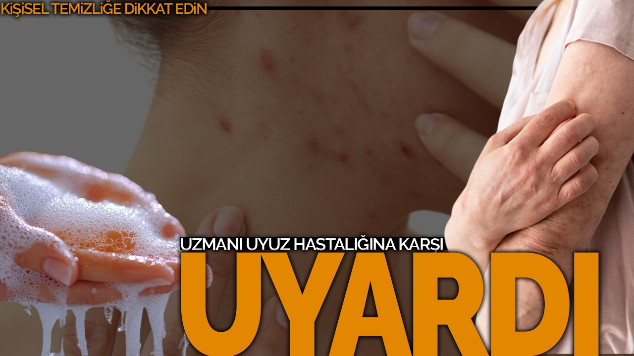 Uzmanı Uyuz Hastalığına Karşı Uyardı: Kişisel Temizliğe Dikkat!