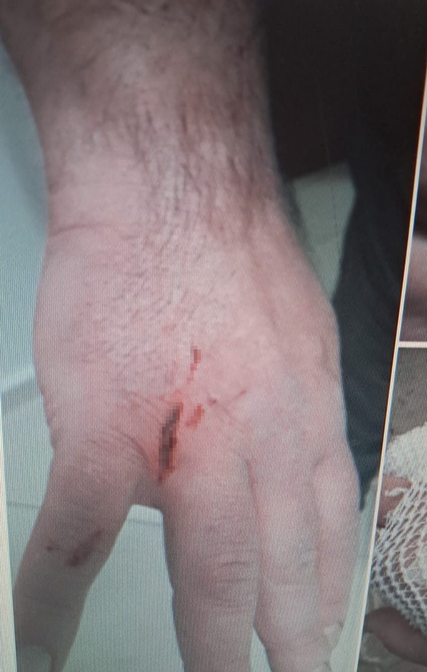 Kocaeli'de Dehşet Anları: Başsız Pitbull, Köpeği Parçaladı! - Sayfa 2