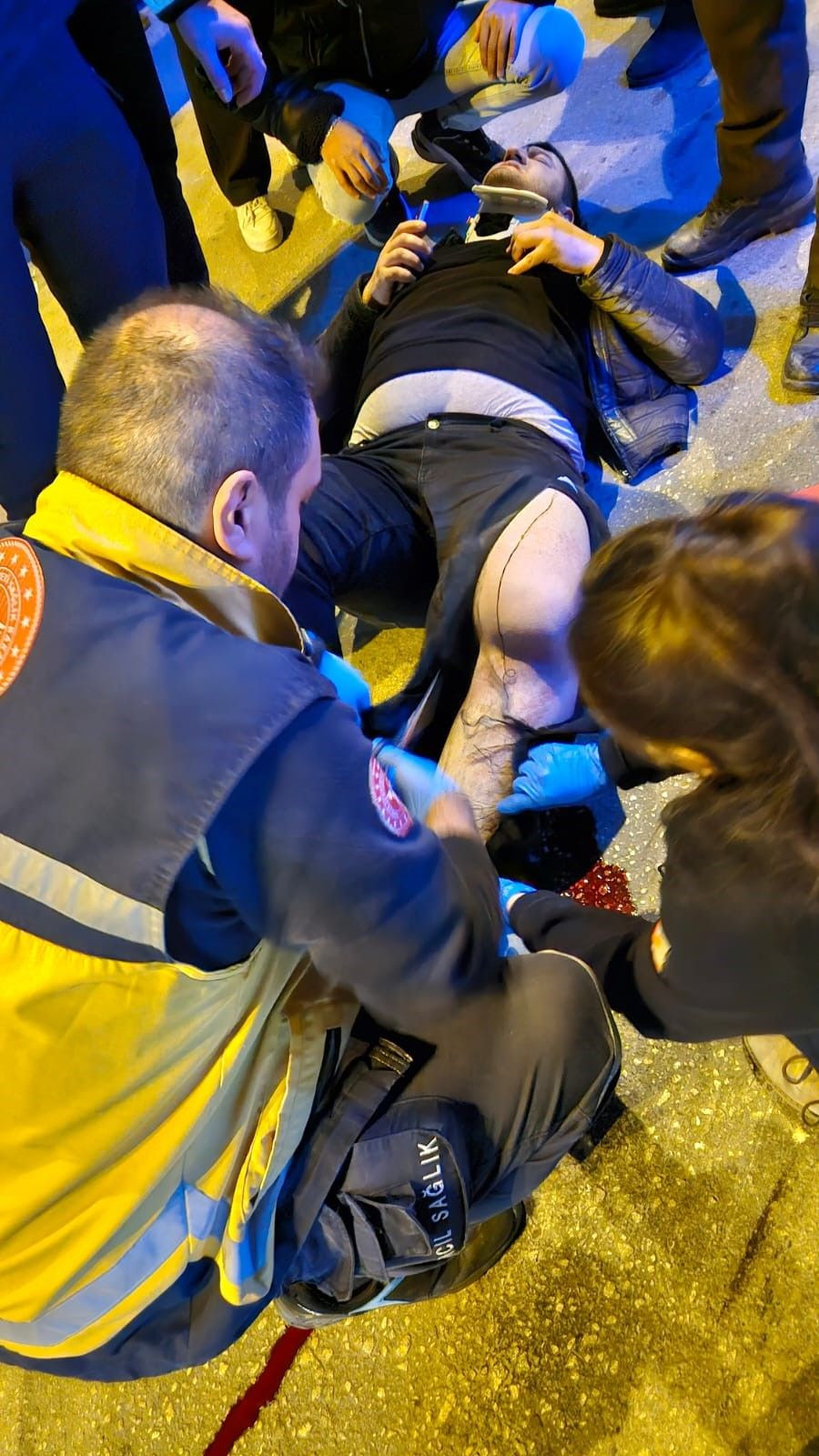 Sokak Köpeklerinden Kaçarken Kamyonet Çarptı! - Sayfa 4