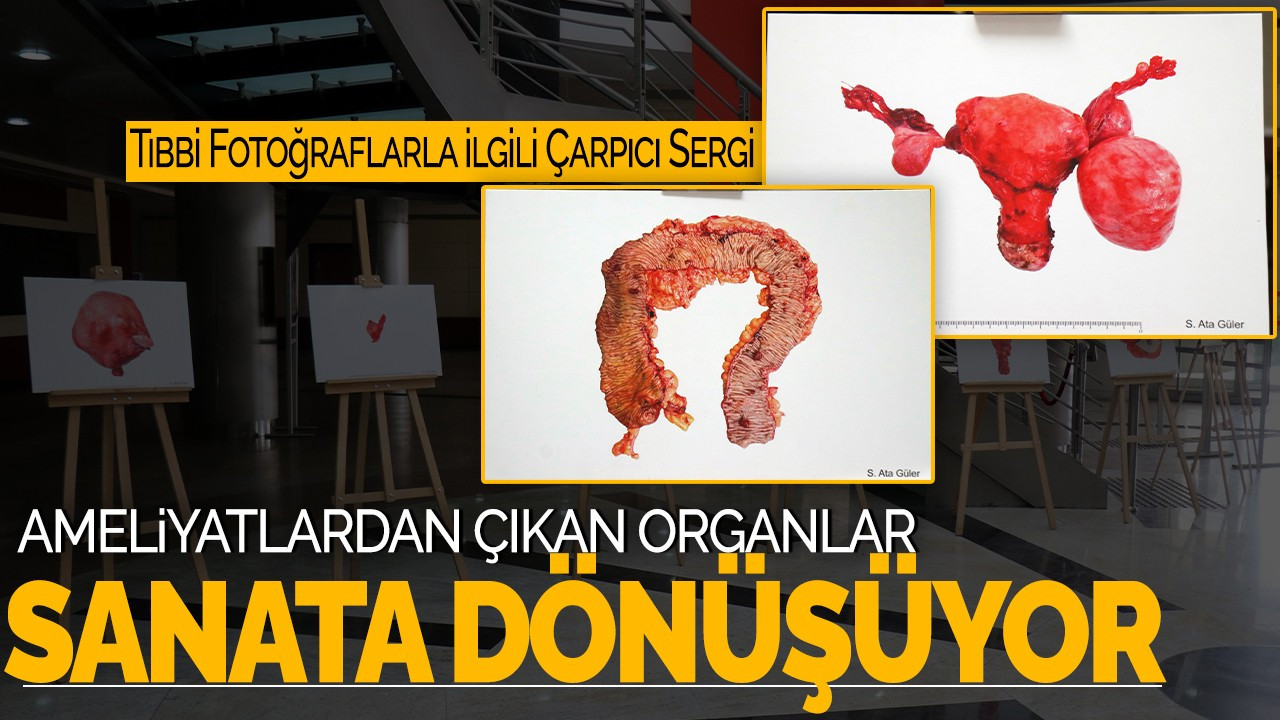 Ameliyatlardan Çıkan Organlar Sanata Dönüşüyor! Tıbbi Fotoğraflarla İlgili Çarpıcı Sergi