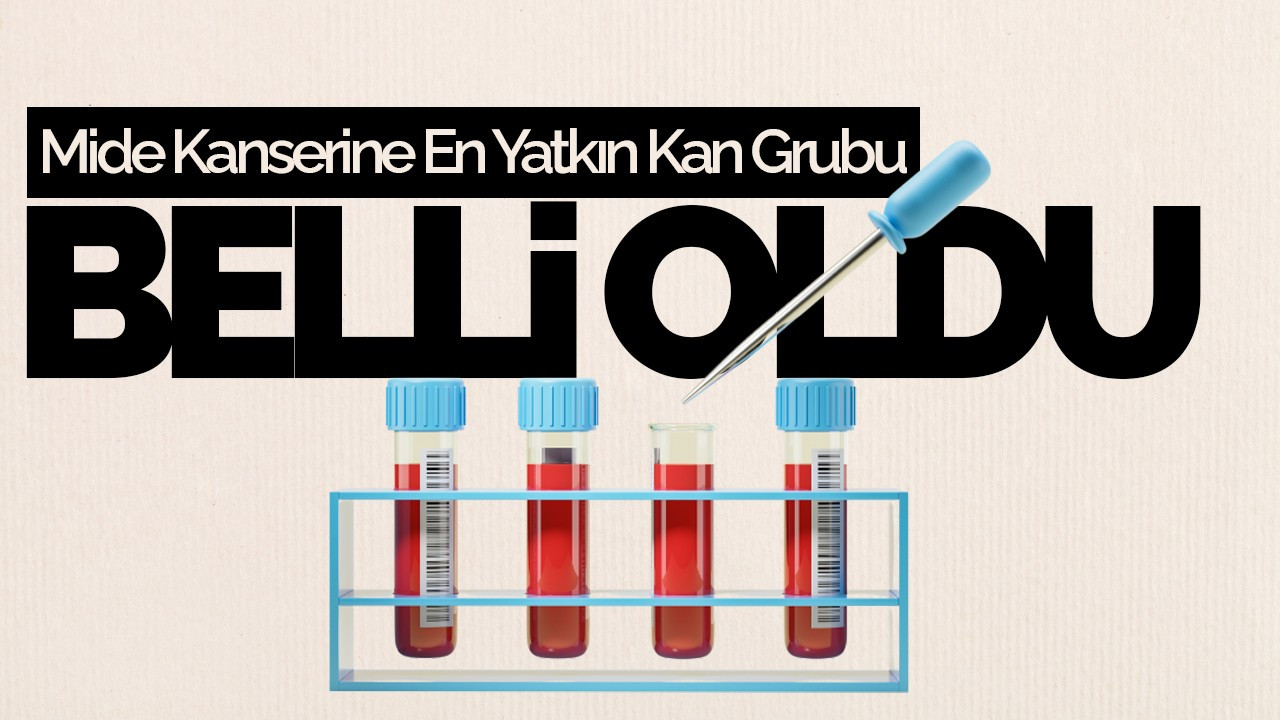 Mide Kanserine En Yatkın Kan Grubu Belli Oldu