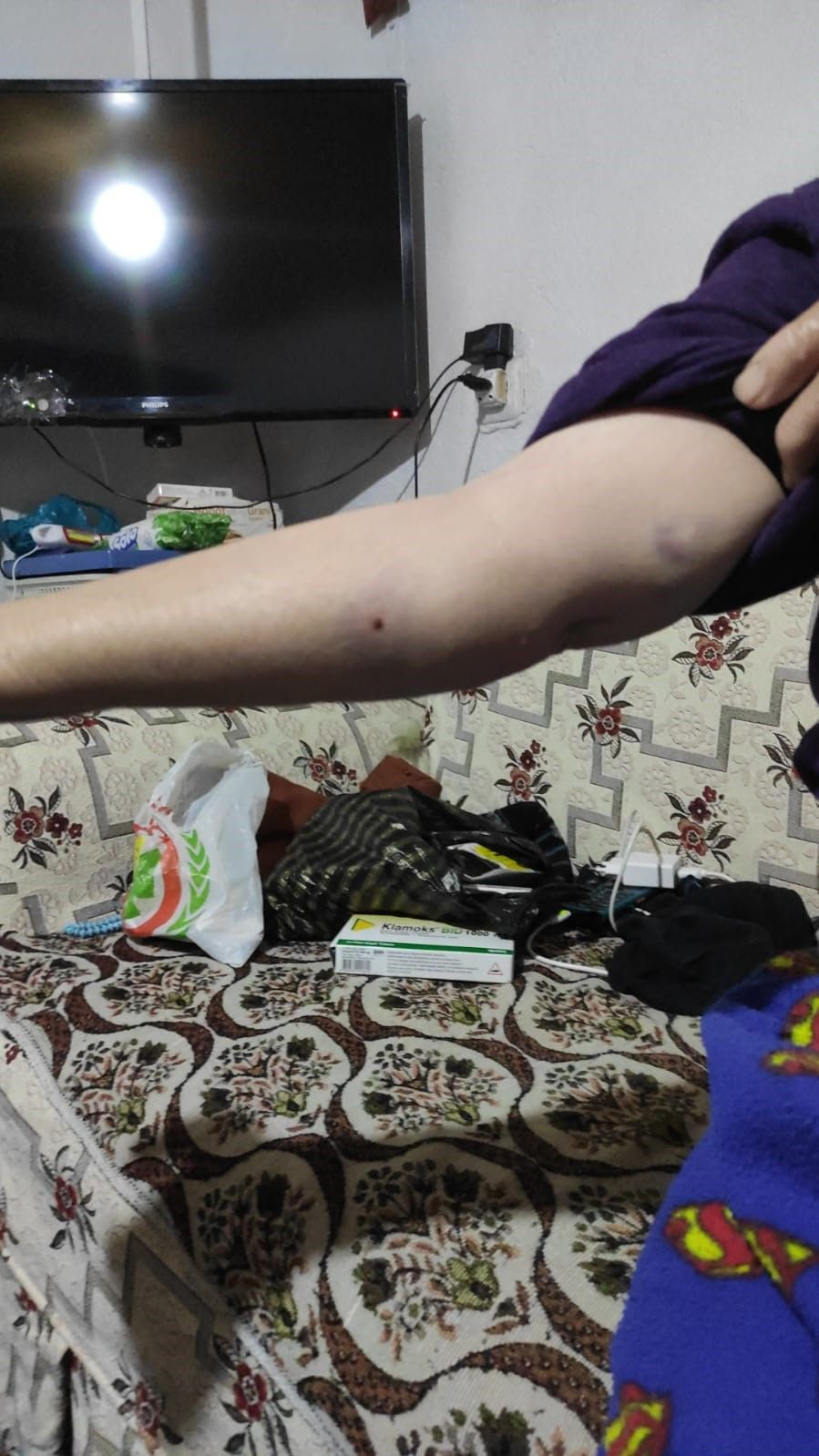Köpeklerin Saldırısına Uğrayan Yaşlı Kadın Yaralandı - Sayfa 3