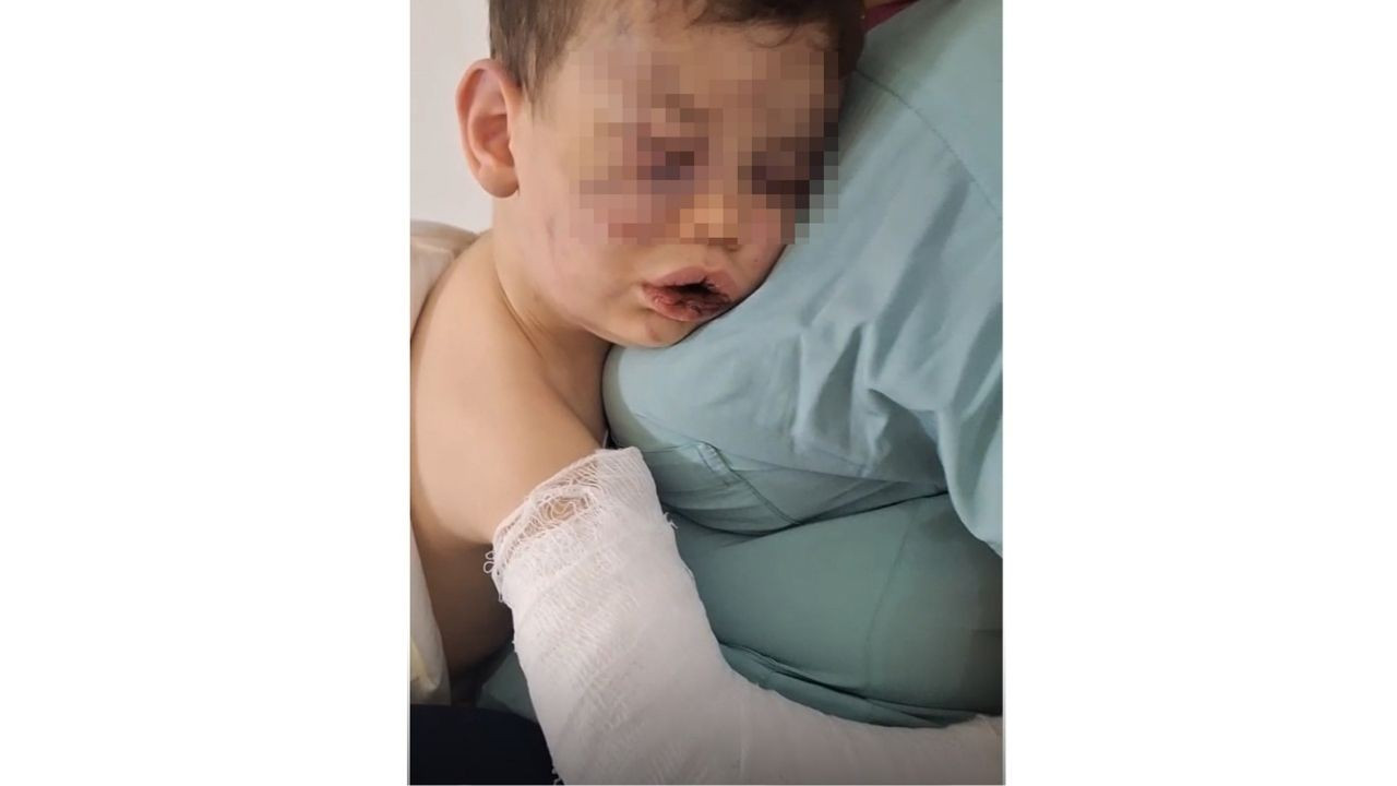 Vahşeti yaşayan 2 yaşındaki bebek hastanelik oldu