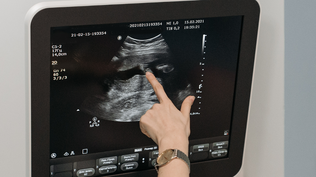 Sağlık Bakanlığından 18 Bin Yeni Personel Atama Müjdesi! - Sayfa 1