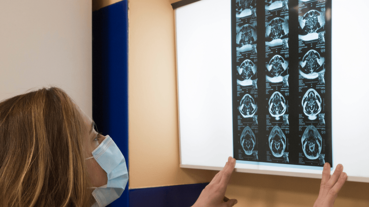 Sağlık Bakanlığından 18 Bin Yeni Personel Atama Müjdesi! - Sayfa 3