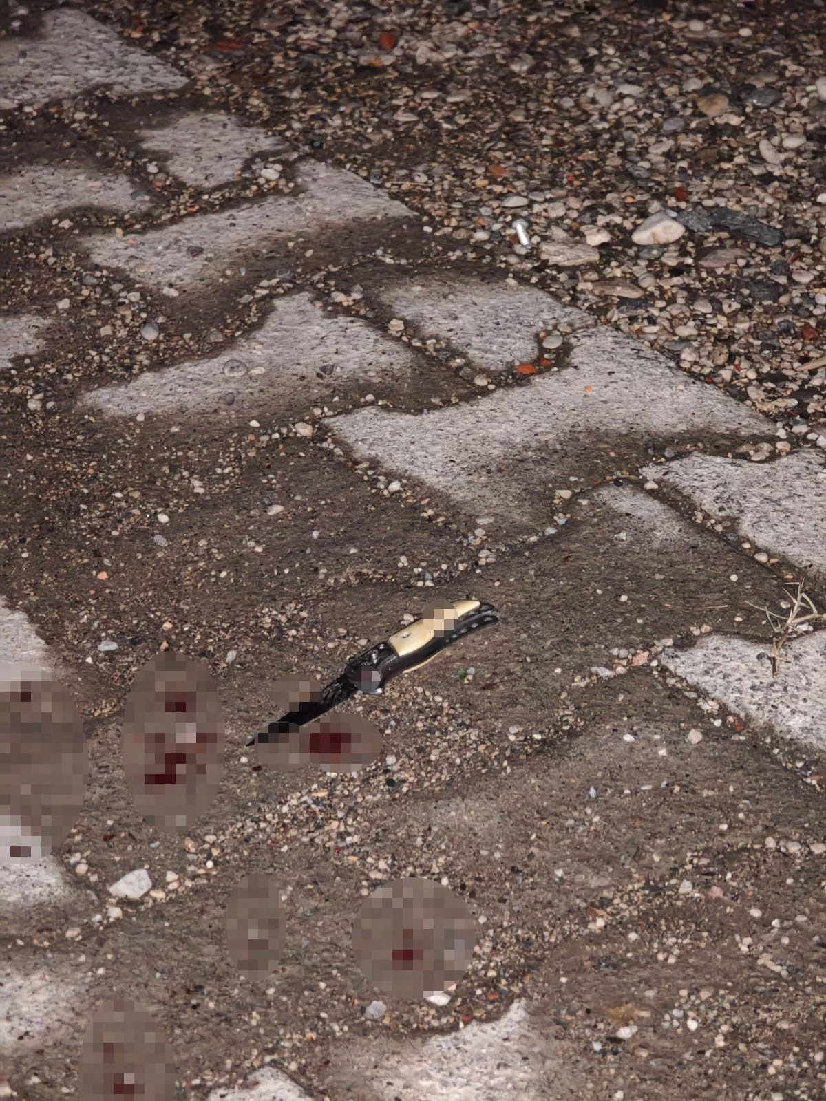 Sakarya’da Kız Meselesi Kanlı Bitti: 16 Yaşındaki Genç Yoğun Bakımda - Sayfa 2