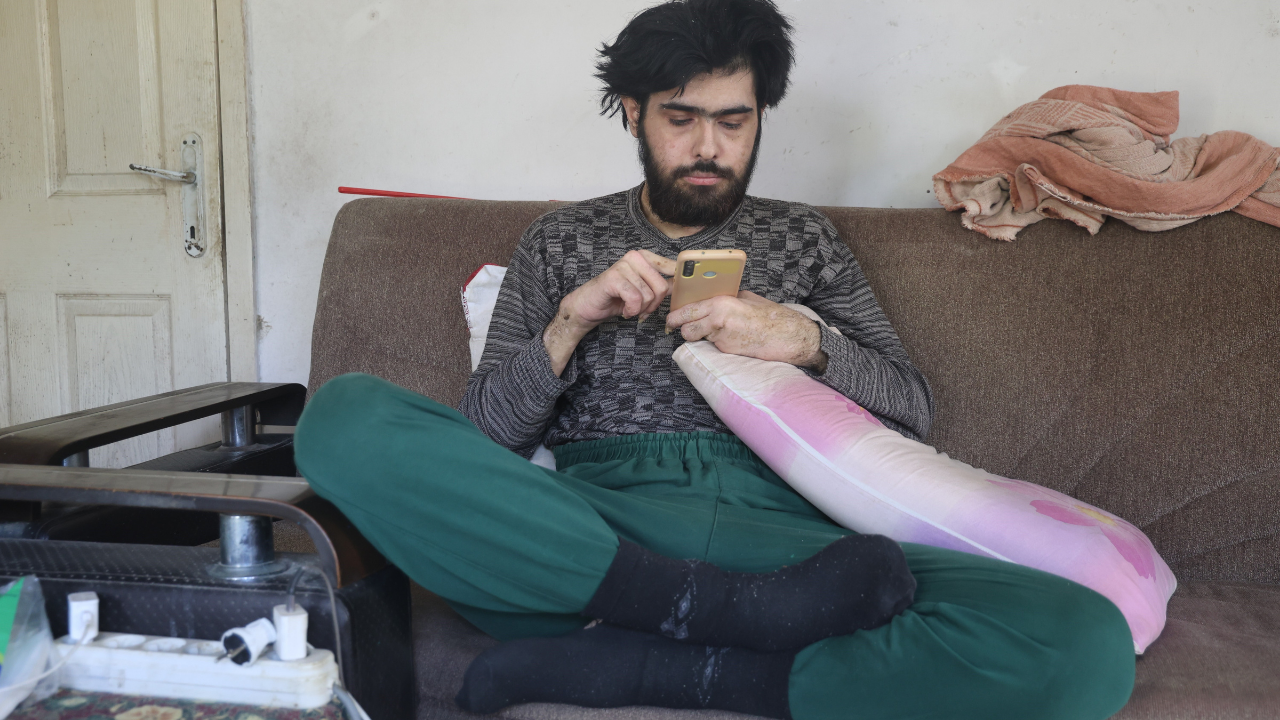 3 Yıldır Evden Çıkmayan Genç İlk Defa Dışarı Çıktı - Sayfa 8