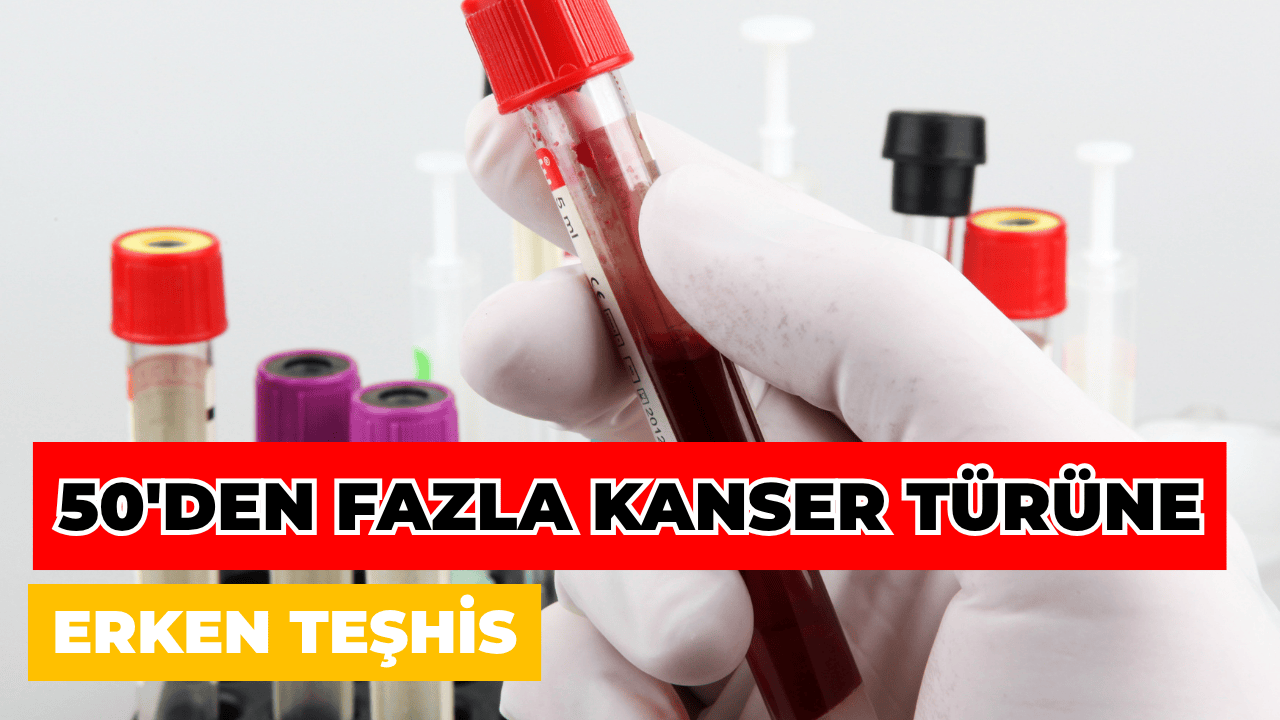 Yeni Kan Testi 50’den Fazla Kanser Türünü Erken Evrede Yakalıyor
