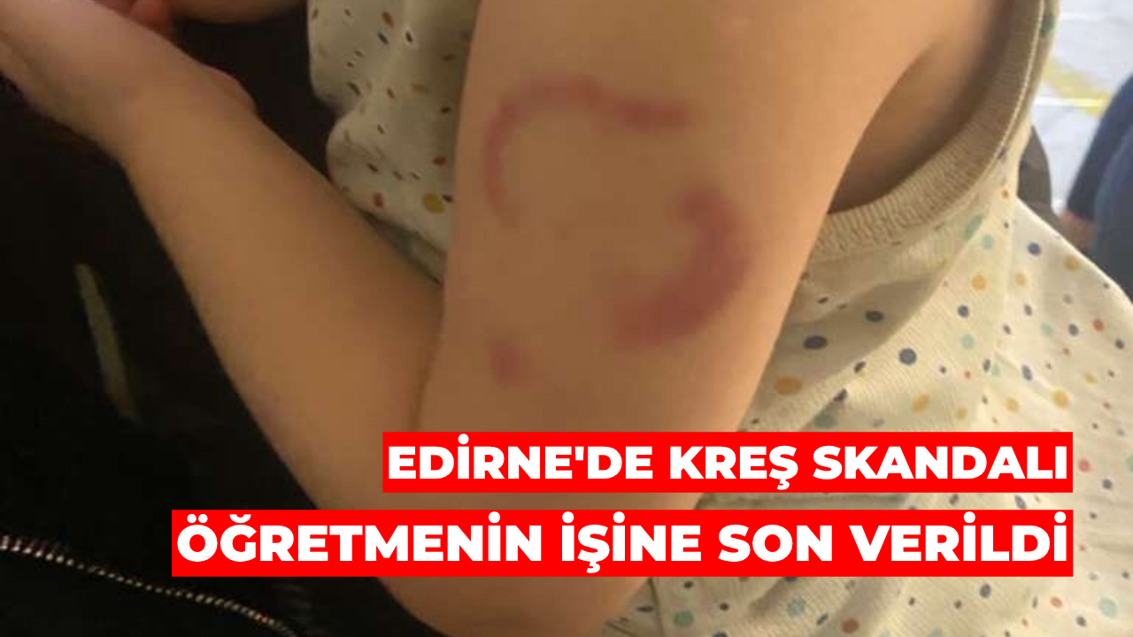 Edirne'de Kreş Skandalı: Öğretmenin İşine Son Verildi