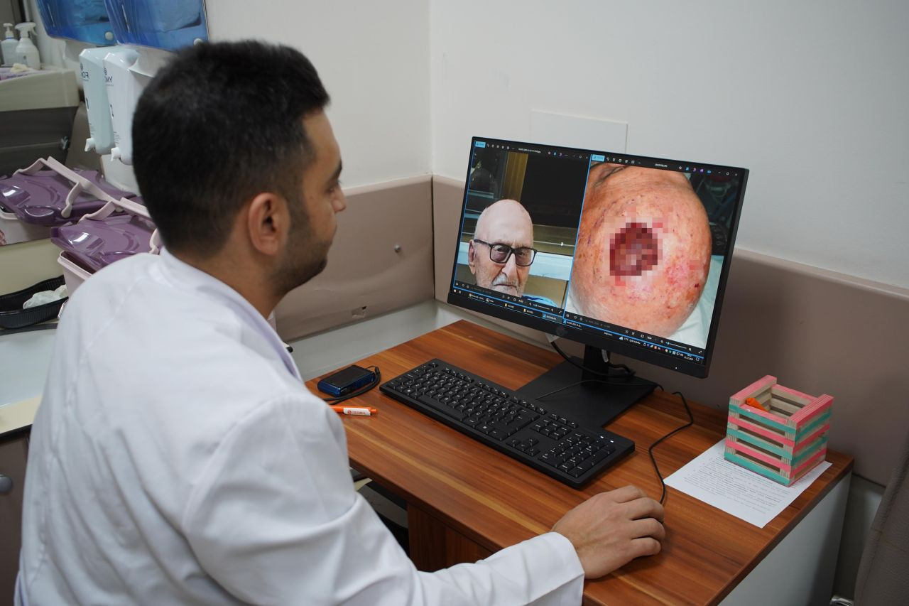 Dünyada 3’üncü Vaka: Saçlı Derideki Nadir Tümör Sakarya’da Tedavi Edildi - Sayfa 4