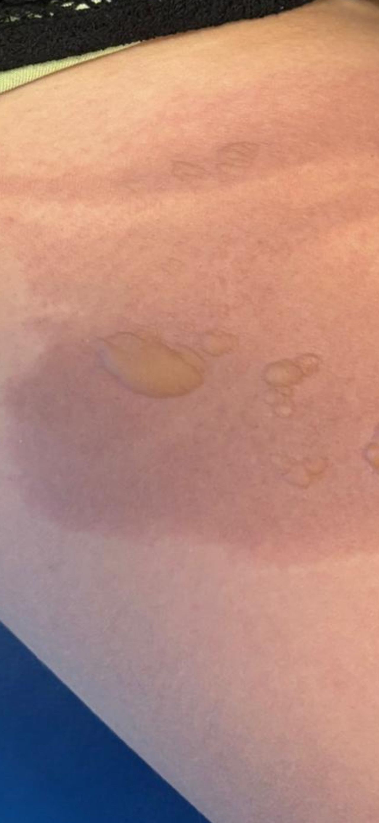 Evdeki Saatli Bomba: Sıcak Su Torbası Dehşeti! - Sayfa 3