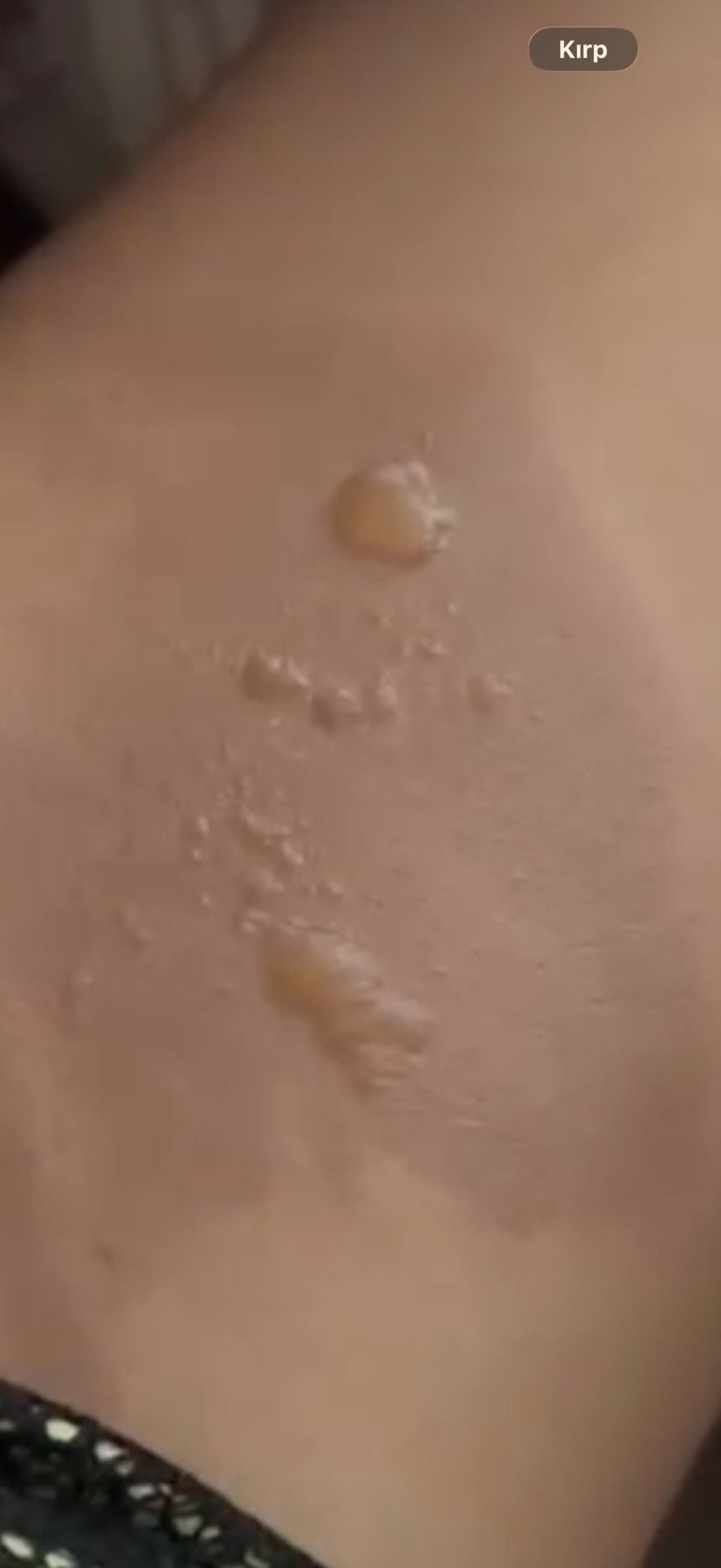 Evdeki Saatli Bomba: Sıcak Su Torbası Dehşeti! - Sayfa 4