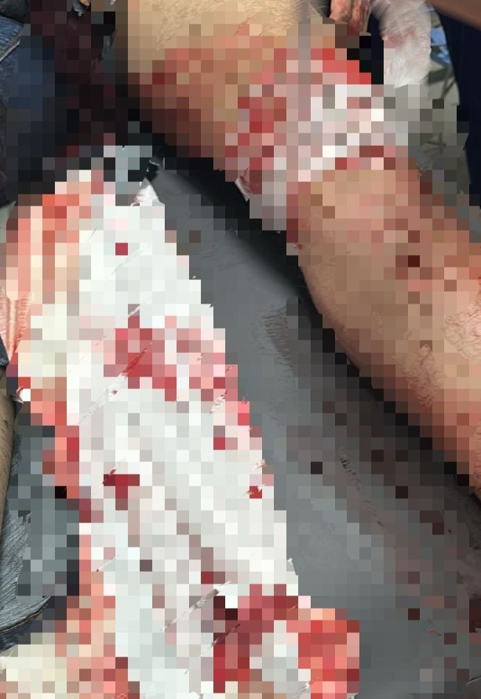 Trafik Cezası Tartışması Bıçaklı Kavgaya Dönüştü - Sayfa 1