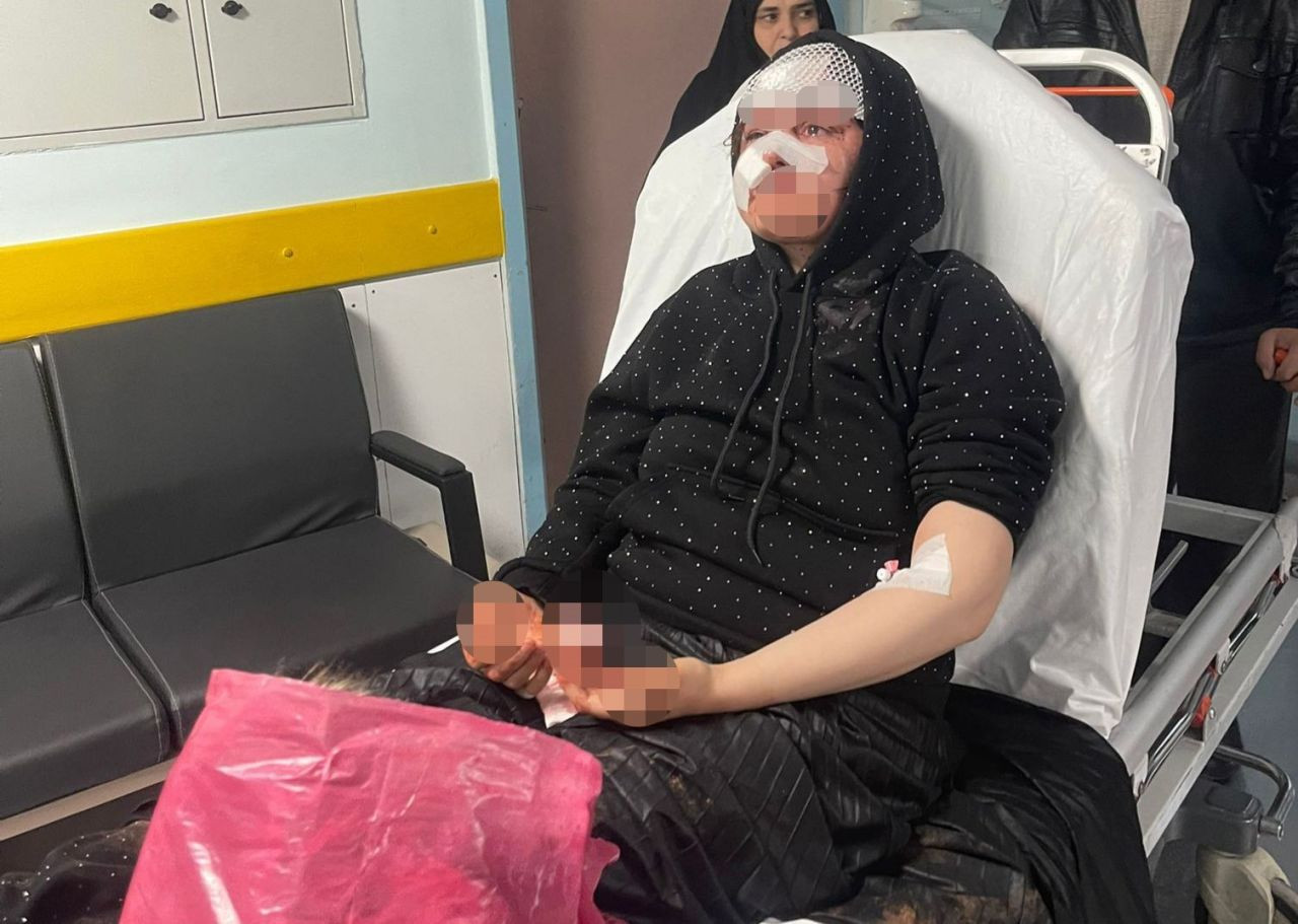 Boşanma Sürecindeki Kadına Vahşi Saldırı: Koca Tutuklandı - Sayfa 1