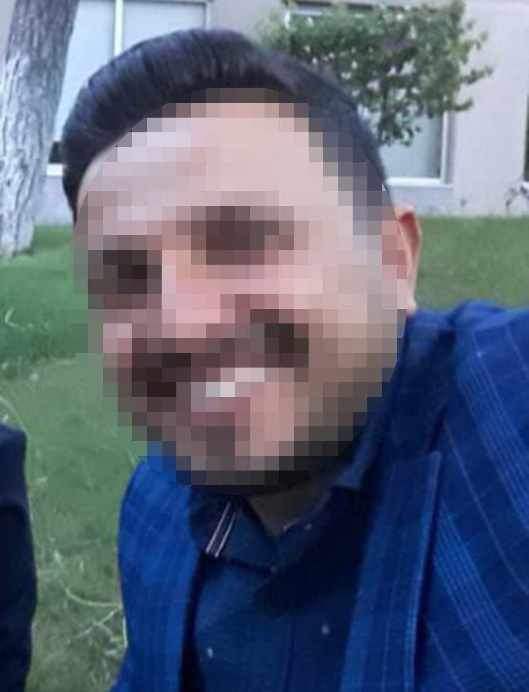 Boşanma Sürecindeki Kadına Vahşi Saldırı: Koca Tutuklandı - Sayfa 3