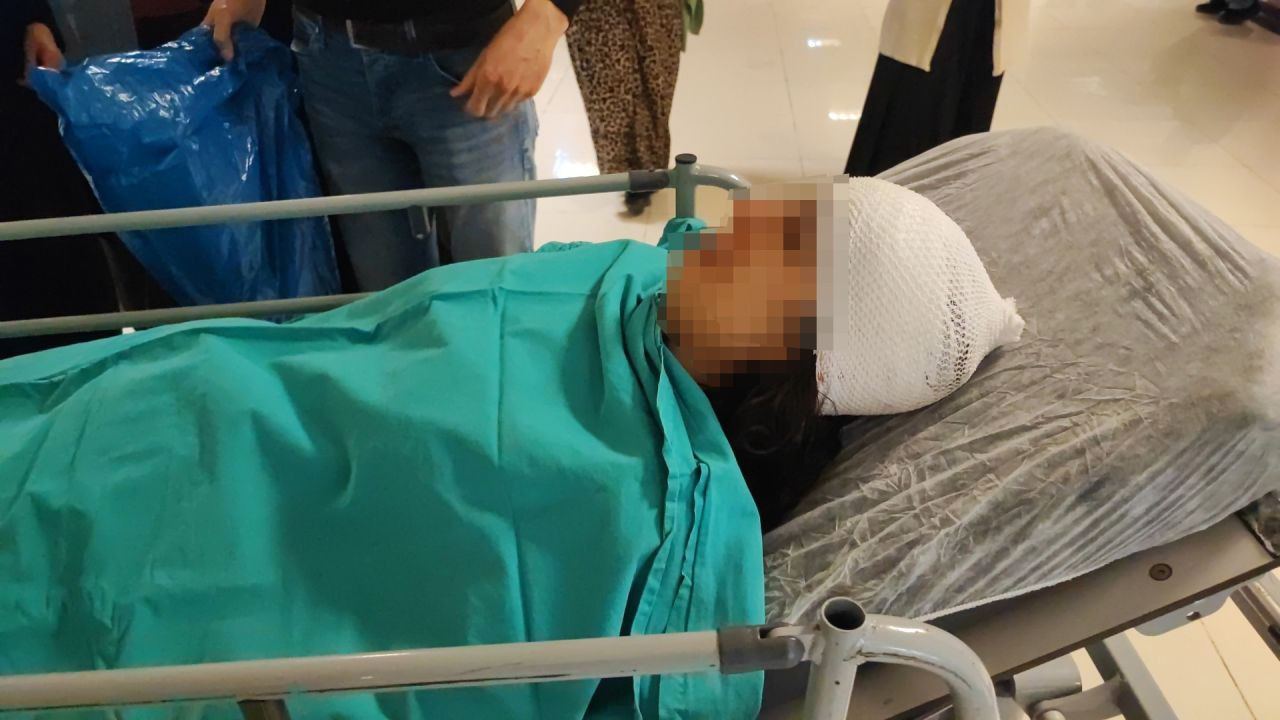 Korku Dolu Anlar: Bakkala Giderken Köpekler Saldırdı - Sayfa 4