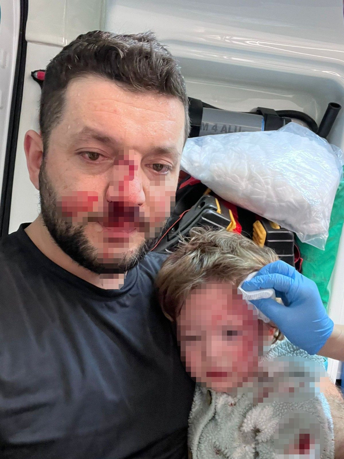 Yalova'daki Vahşette 14 Aylık Bebeğin Kafatasını Çatlattılar! - Sayfa 1