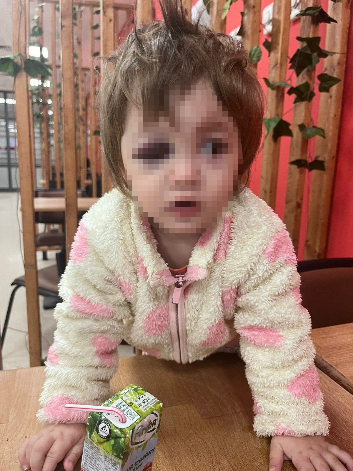 Yalova'daki Vahşette 14 Aylık Bebeğin Kafatasını Çatlattılar! - Sayfa 4